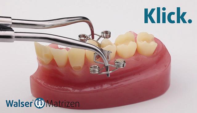 Legen Sie mit der Zahn-Matrize X-Form zwei Füllungen gleichzeitig Legen sie einfach und schnell zwei Füllungen gleichzeitig