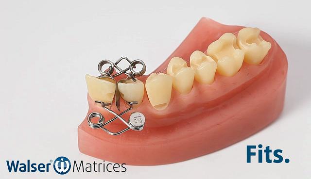 La matriz dental con forma XF se coloca con un solo movimiento de la mano Coloque la matriz dental con forma XF, que se adapta automáticamente al diente con un movimiento de la mano