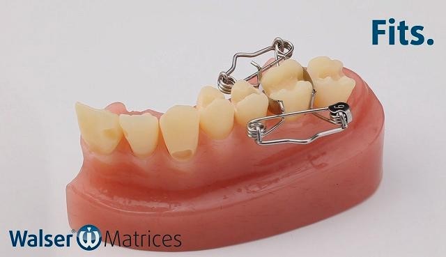 Coloque la matriz dental con forma de O, que se adapta automáticamente al diente con un movimiento de la mano