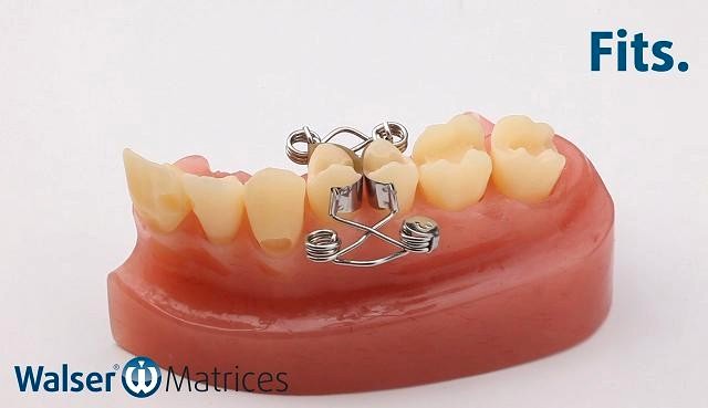 Coloque la matriz dental con forma de X, que se adapta automáticamente al diente con un movimiento de la mano