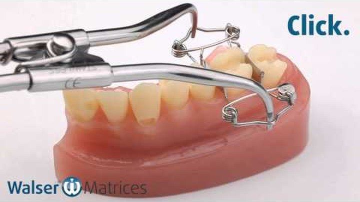 Vídeo: matriz dental Walser en forma de O durante su uso