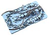 Set of 25 with tray and forceps Set of 25 Walser Dental Matrices in a sterilising tray with forceps