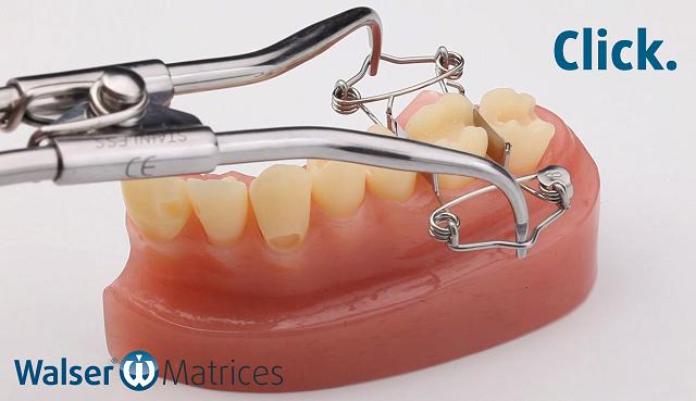 Using the matrix forceps, tighten the tooth matrix and push it over the tooth