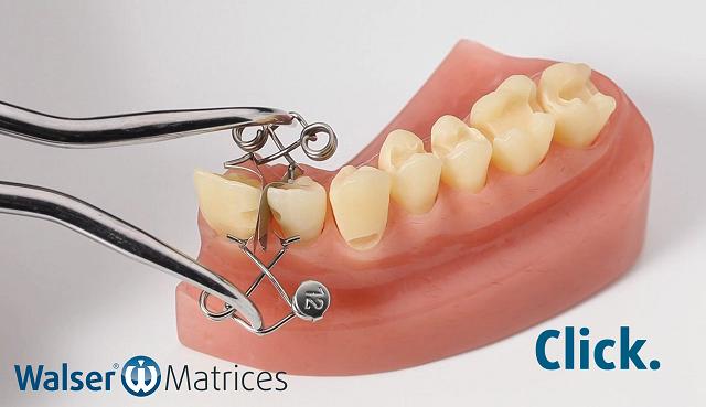 Using the matrix forceps, tighten the tooth matrix xf-shape and push it over the tooth