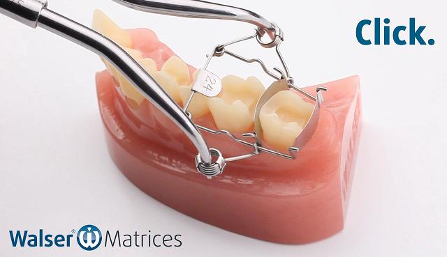 Using the matrix forceps, tighten the tooth matrix on-shape and push it over the tooth