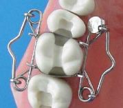 Forme en O matrice pour dent de Dr. Walser Dental