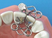 XF-Shape Dental Matrix XF-Shape Dental Matrix from Dr. Walser Dental