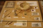 Einige Instrumente und Gefäße im Dentalhistorischen Museum