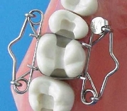 O-Shape Dental Matrix O-Shape Dental Matrix from Dr. Walser Dental